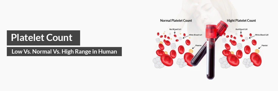  Platelet Count: Low vs. Normal vs. High Range in Human